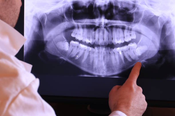 Best Emergency Treatment for Dental Infections or Abscesses in Maben, MS